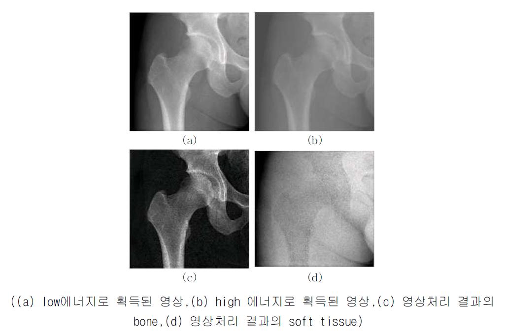 Lexxos로 획득된 영상과 결과