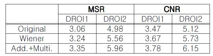 잡음 제거 전과 후의 뼈 분해 영상의 MSR과 CNR (Original:원본 영상, Wiener:Wiener 필터 적용 영상, Add.+Multi.: 가산성 및 적산성 잡음 제거 영상)