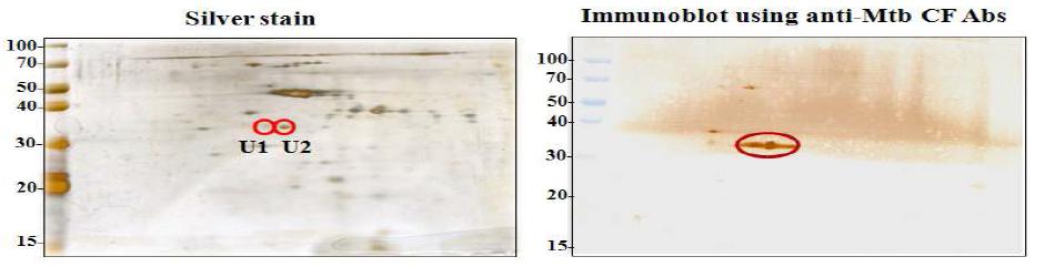 2-DE analysis of urine from tuberculosis patients