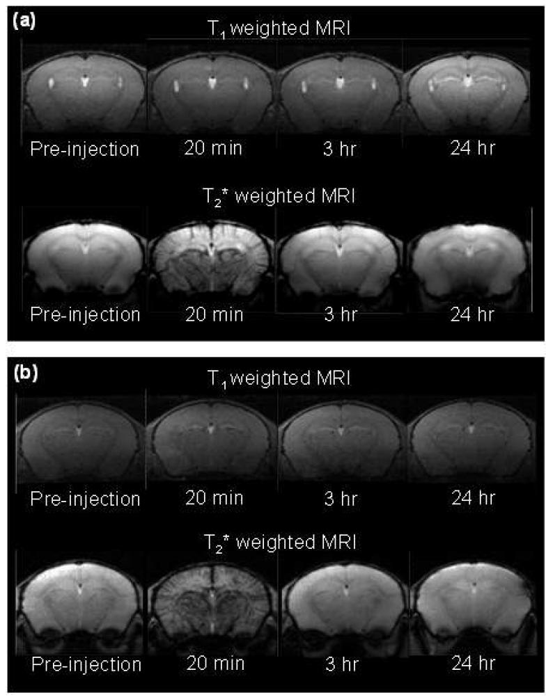 (a) dumbbell-like Fe3O4/MnO 과 (b) 11 nm 크기의 Fe3O4 나노입 자를 쥐의 혈관에 주사한 후에 얻은 T1 weighted와 T2 * weighted MRI 영상.