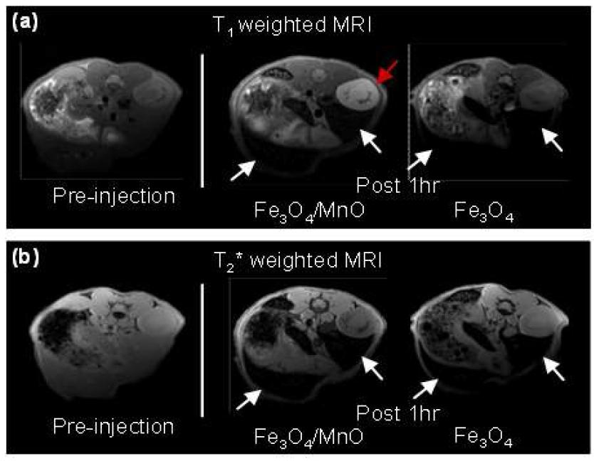 쥐의 혈관에 나노입자를 주사하기 전 (왼쪽), dumbbell-like Fe3O4/MnO 혼성나노입자 (가운데), 11 nm 크기의 Fe3O4 나노입자를 주사하고 1시간 후의 a) T1- 그리고 (b) T2 * - weighted 복부 MRI 영상.
