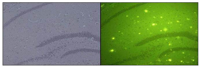 Congo red (left panel) and thioflavin S (right panel) staining of amyloid beta depositsin the hippocampus area of B6C3 transgenic mice aged 15 months.