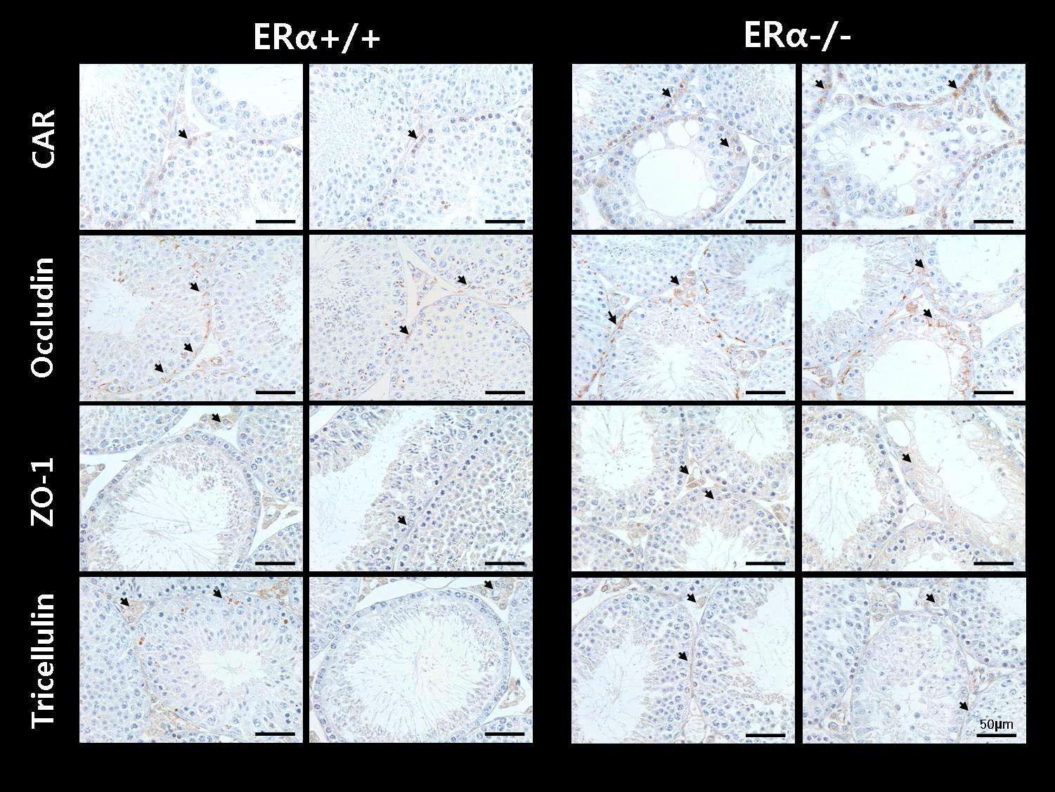 ERα KO mice의 정소 내 밀착결합 단백질의 발현 변화