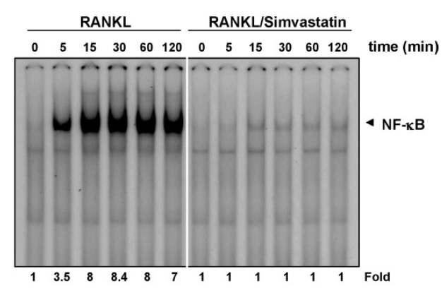 파골세포 분화시 Simvastatin을 같이 처리한 NF-kB의 발현 양 비교