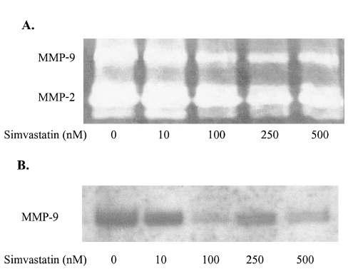 Simvastatin 처리시 MMP-9, MMP-2의 활성과 단백질 발현 양 비교