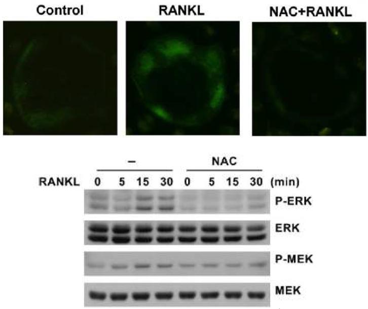 파골세포 분화시 NAC 효과와 EPK 발현 양 비교