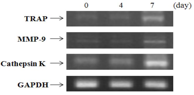 치주인대세포를 7일 동안 분화한 후TRAP, MMP-9, Cathepsin K mRNA 발현도 조사.