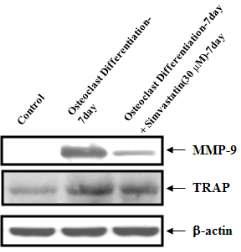 치주인대세포를 파골세포로 분화한 후와 Simvastatin 약물을 처리하여MMP-9, TRAP 단백질 발현도 조사.