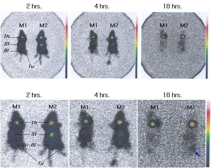 종양 모델 마우스에서 [123 I]Iodo-QP6Y (M1) 또는 [123 I]Iodo-FP6Y (M2) 정맥투 여 후 시간 경과에 따른 감마카메라 영상.