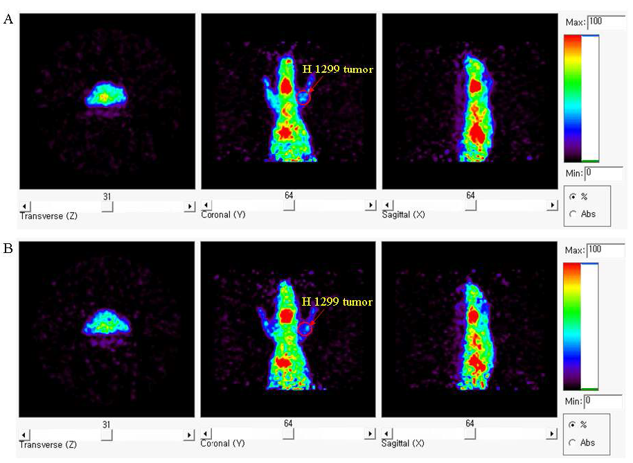 종양 모델 누드마우스에 [124 I]Iodo-FP6Y 투여 후 획득한 MicroPET 영상.