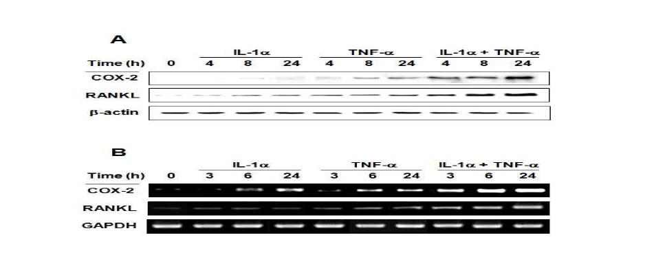 Effects of proinflammatory cytokines on COX-2 and RANKL protein (A) and mRNA (B) inhuman dental pulp cells.