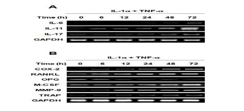 Effects of proinflammatory cytokines on osteoclastogenic genes (A) and markers of bone resorption (B) in HDP cells.