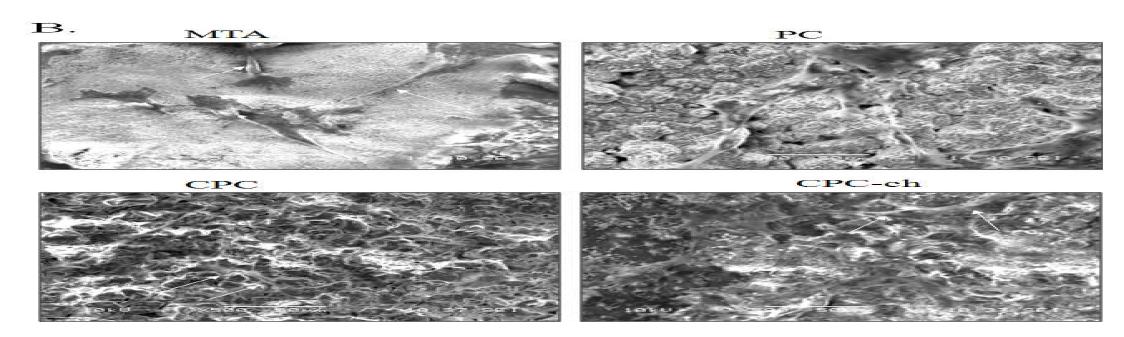 SEM morphology of the CPC (A) and chitosan-CPC (B, C).