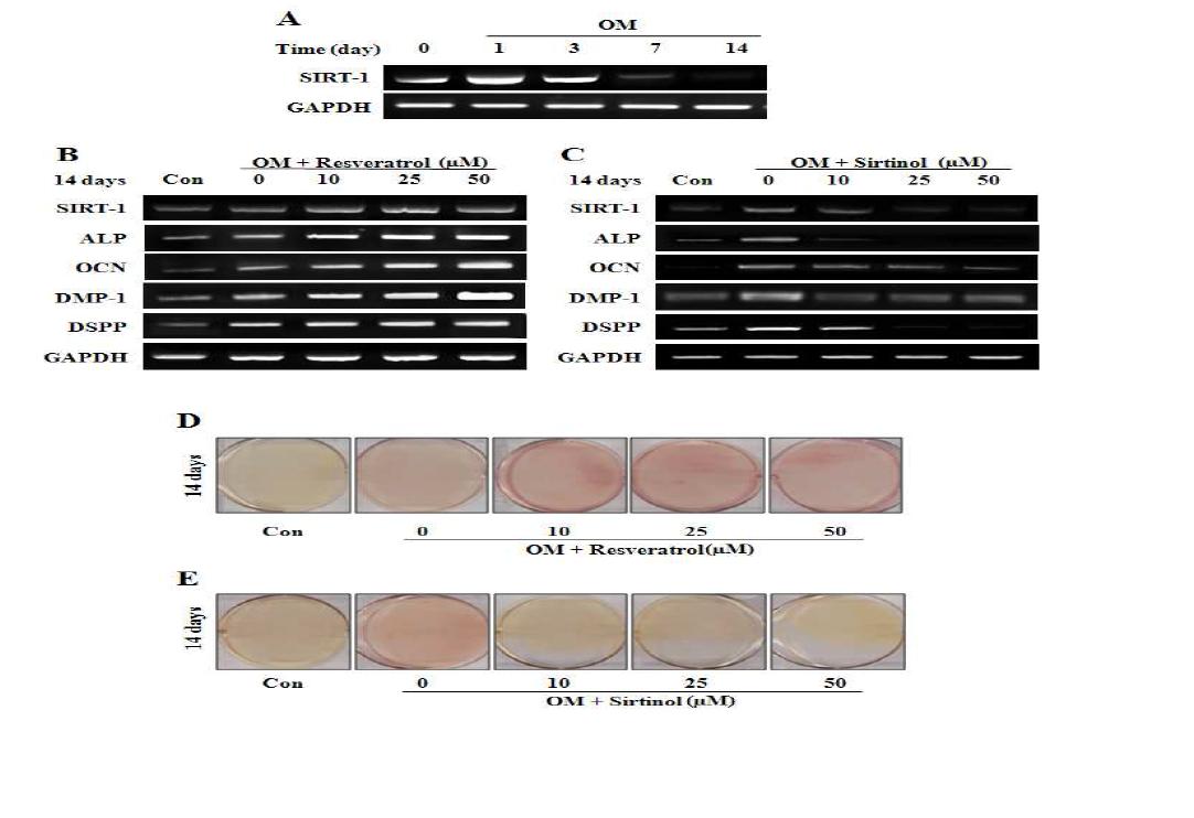 SIRT1 mRNA expression during odontogenic differentiation (A), effects of SIRT1 activation andinhibition on odontoblastic differentiation (B–E) in HDPCs.