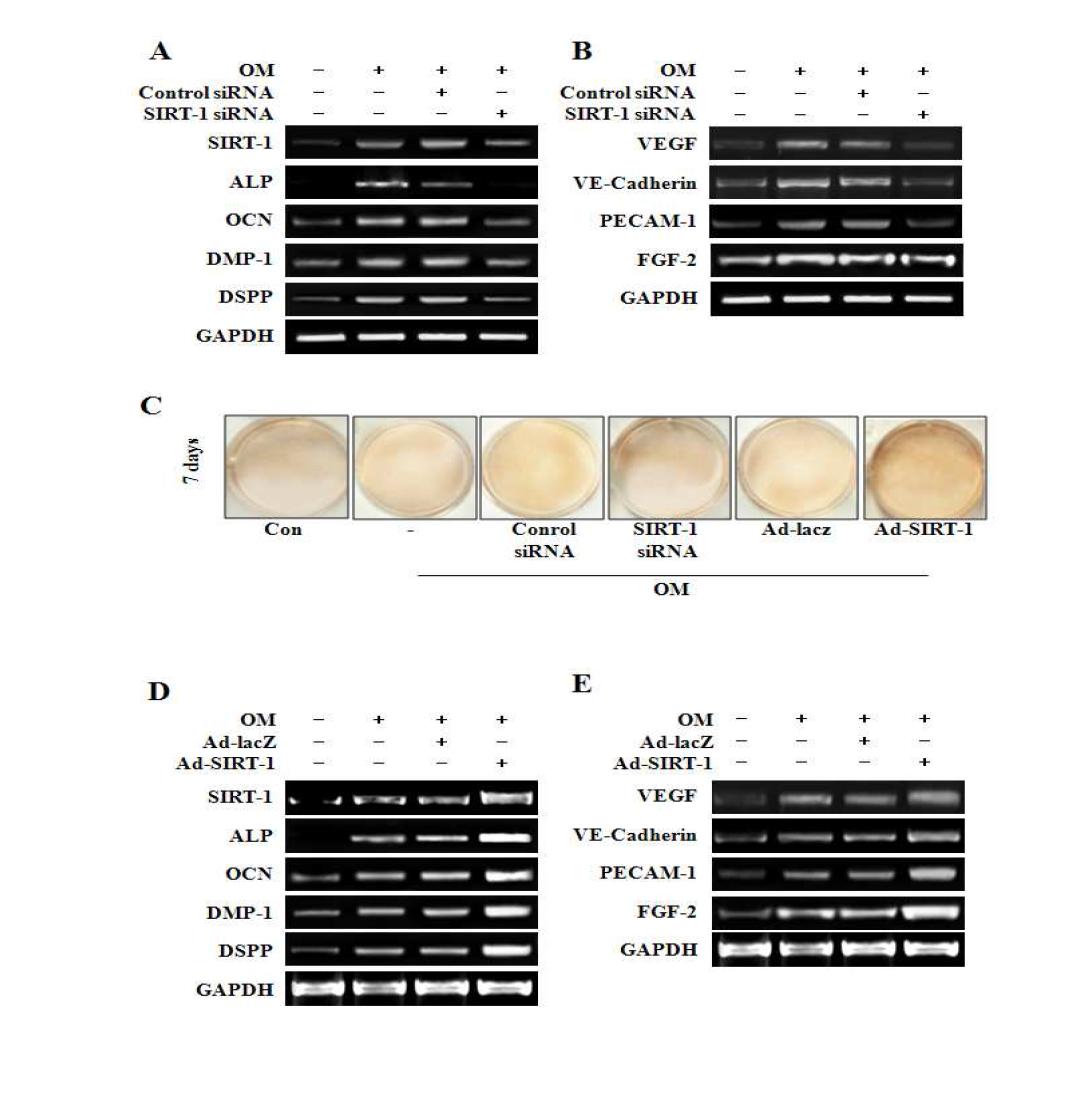 Effects of SIRT1 siRNA and adenovirus-SIRT1 on odontogenic potential (A, B, C) and angiogenicfactors (D, E) in HDPCs.