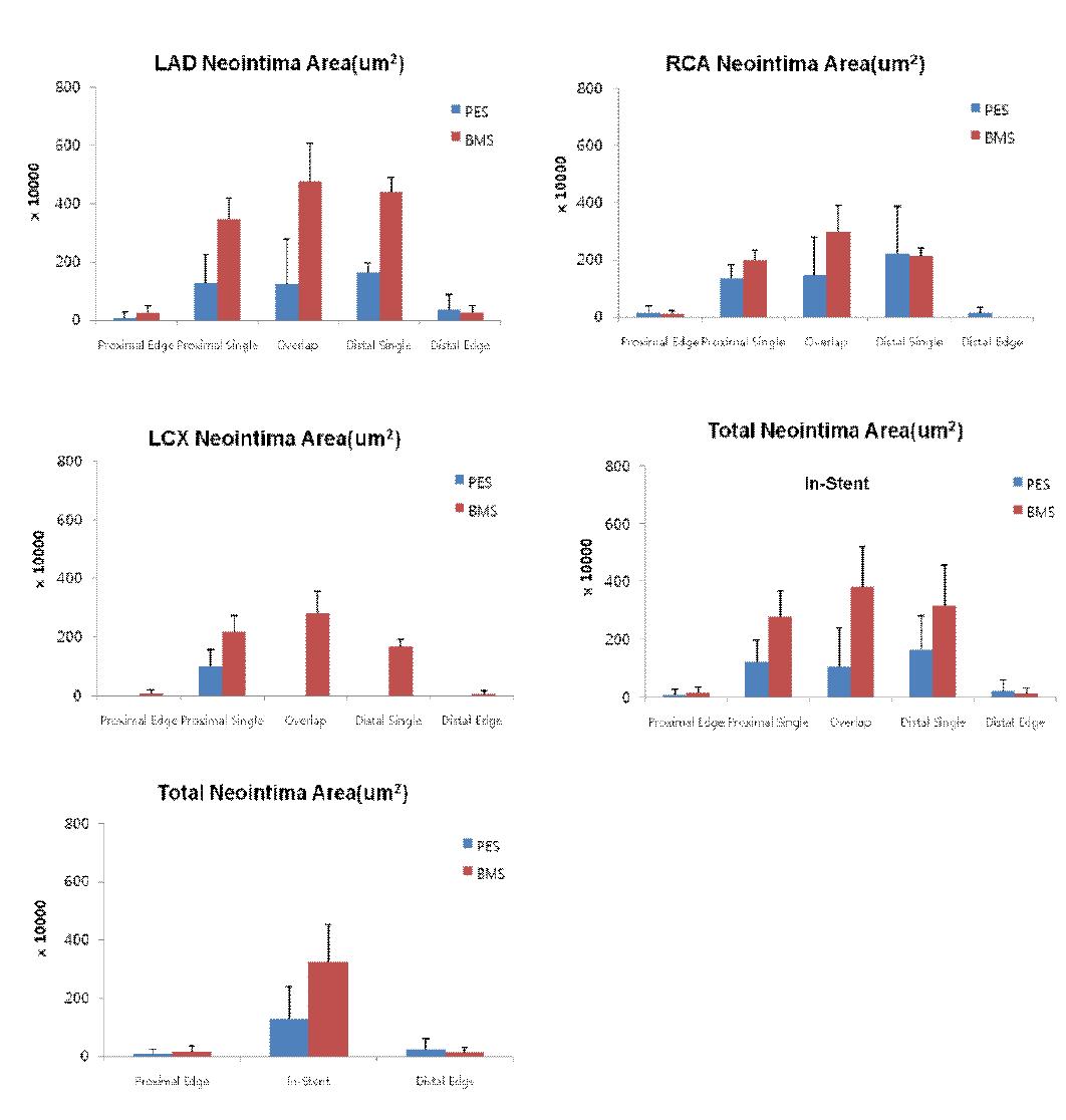 Neointima Area Analysis