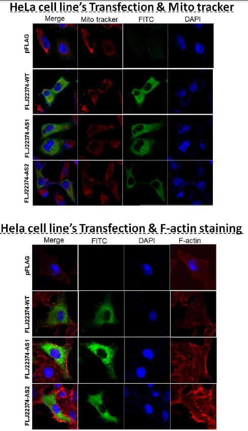 그림 2-92. HEK-293 cell에서 mitotracker, phalloidin 이용하여 FLJ22374의 발현위치를 분석한 HEK-293 cell에서 AS form을 과발현할 때 핵 주위에 진하게 염색되는 부위가 mitochondria와 겹치는 현상이 관찰되었으나, 이 부위가 aggresome이라는 세포내 구성물과 유사한 형태를 나타내 어 이를 확인하기 위하여 다음과 같은 실험을 수행하였다