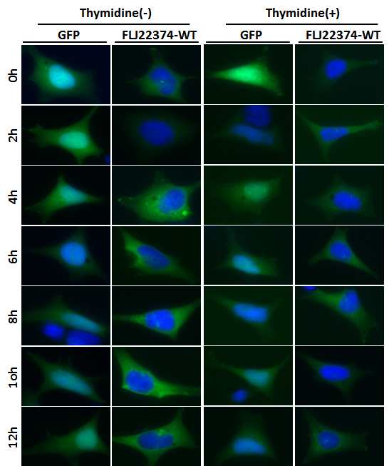 그림 2-96. Confocal microscopy를 이용하여 2시간 간격으로 FLJ22374 WT protein의 세포내 이 동을 관찰할 결과