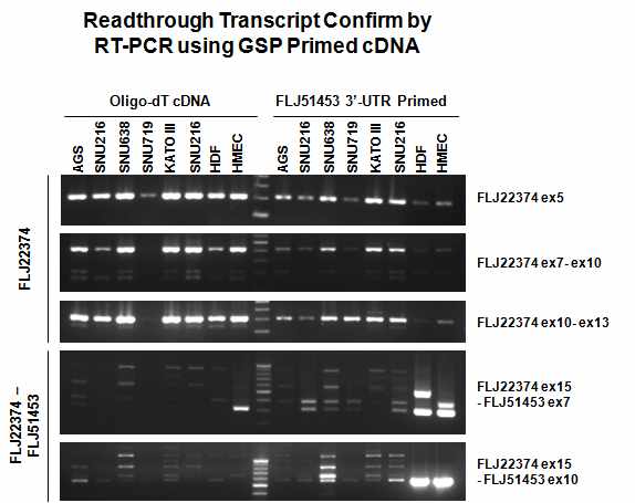 그림 2-5. 위암 세포주 및 normal cell에서 oligo d(T)와 FLJ51453 (fusion transcript)에 특이적인 primer를 각각 이용하여 수행한 FLJ22374와 fusion transcript에 대한 exon-wise RT-PCR의 결과