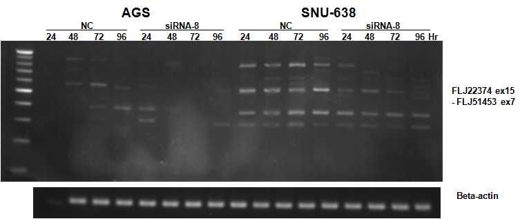 그림 2-7. 위암 세포주에 FLJ22374 specific한 siRNA 처리 후 fusion transcript의 expression pattern을 비교한 결과