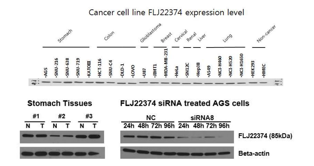 그림 2-13. Cancer cell line과 stomach tissues에서 F374C antibody로 detect한 FLJ22374 protein