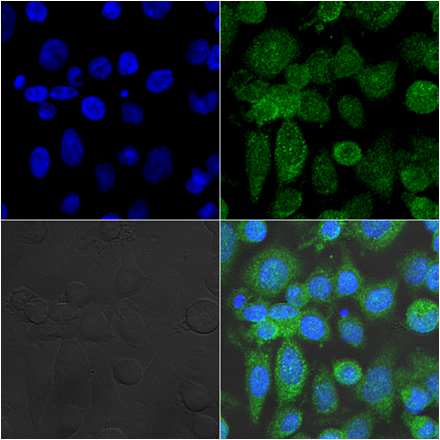 그림 2-14. F374c antibody를 이용하여 immunocytochemistry를 수행한 결과