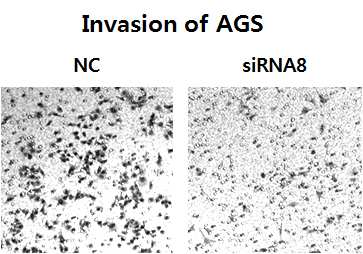 그림 2-19. FLJ22374 siRNA treatment에 의해 AGS cell의 invasion이 감소한 결과.