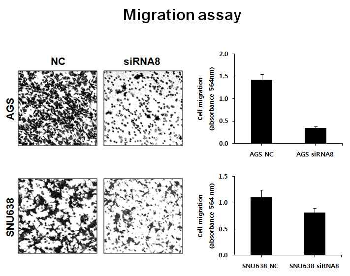 그림 2-20. FLJ22374 siRNA treatment에 의하여 cell migration이 감소한 결과.