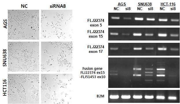 그림 2-22. FLJ22374 siRNA처리에 의하여 감소된 cell proliferation과 RNA level의 확인.