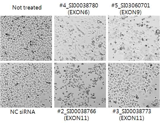 그림 2-26. GPNMB exon 5, 6, 11에 specific한 siRNA treatment에 따른 cell growth pattern의 차 이.