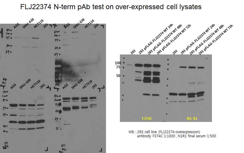 그림 2-34. FLJ22374 N-terminal에 대한 4가지의 polyclonal anti-serum (left)의 cell line lysate에 대한 western blot 및 293 cell over-expressed lysate에 대하여 c-term antibody와 비교한 western blot 결과 (right).