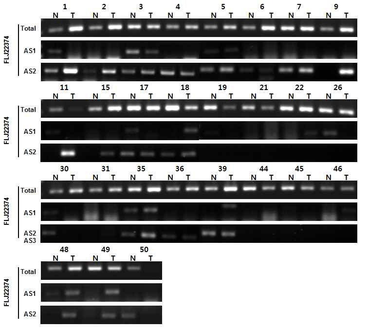 그림 2-54. FLJ22374의 AS form을 27 pair의 위암환자 시료를 통하여 비교한 결과