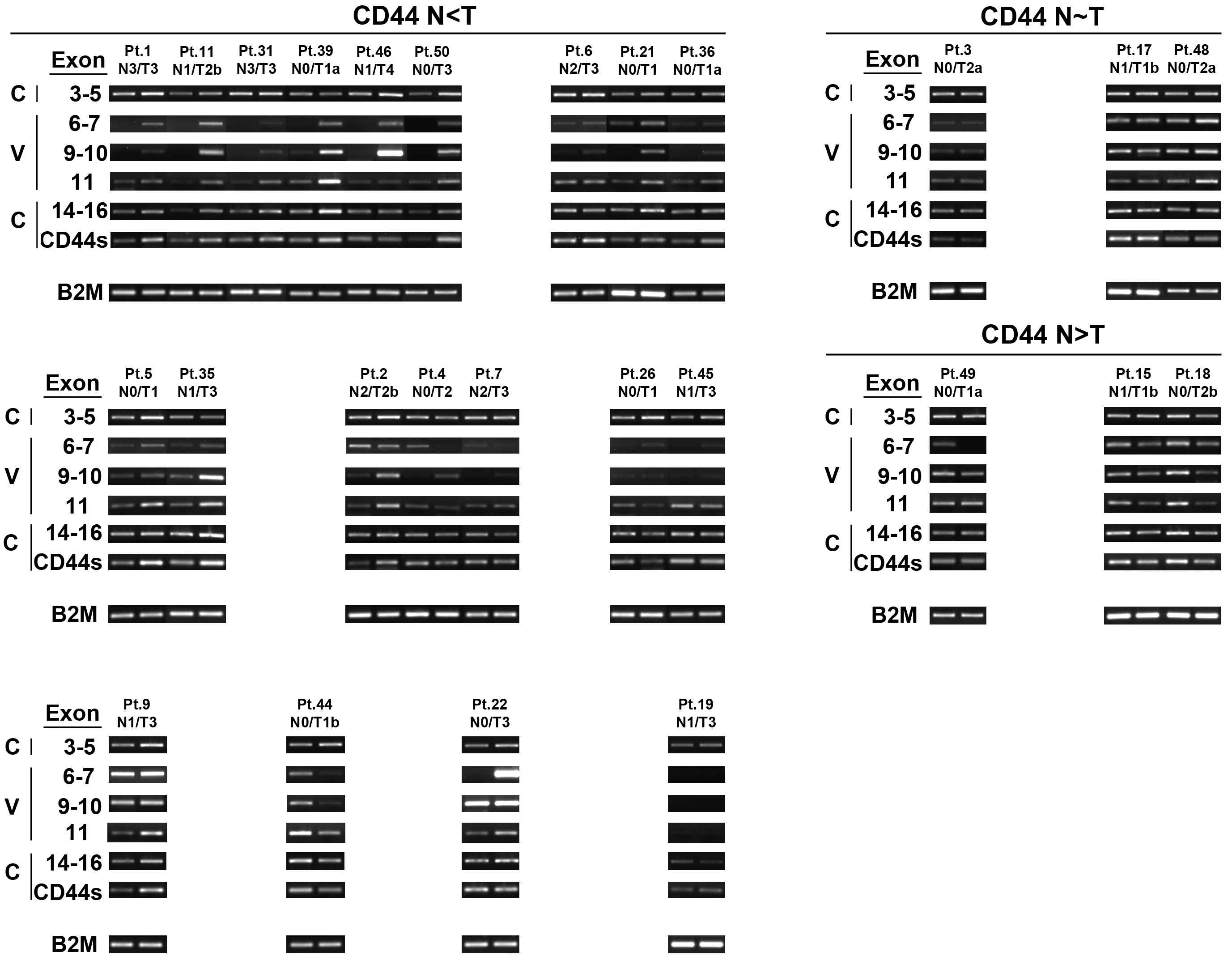 그림 2-59. CD44 constant region과 variable region의 exon별 RT_PCR을 위암환자의 cDNA를 대상으로 수행한 결과