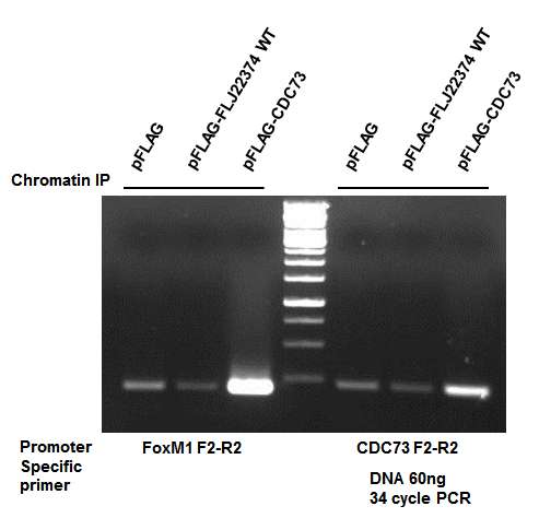 그림 2-72. FLJ22374 단백질과 상호작용하는 CDC73에 영향을 받는 유전자들 (FoxM1 및 CDC73)의 promoter부위에 대한 ChIP PCR결과.