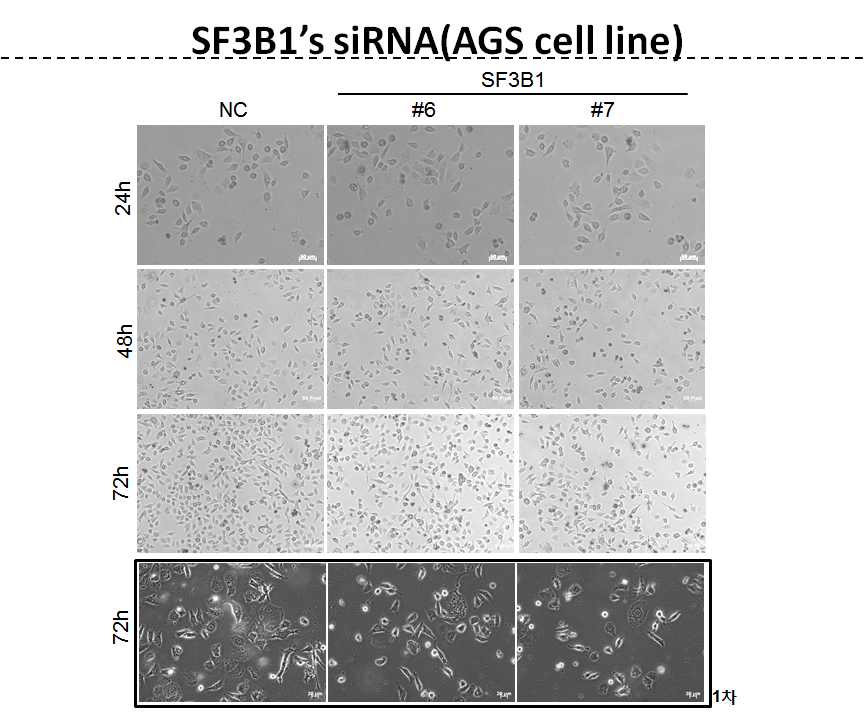 그림 2-84. AGS 및 HCT-116 cell line에 대하여 SF3B1의 발현을 suppress 했을 때 나타나는 cell death현상