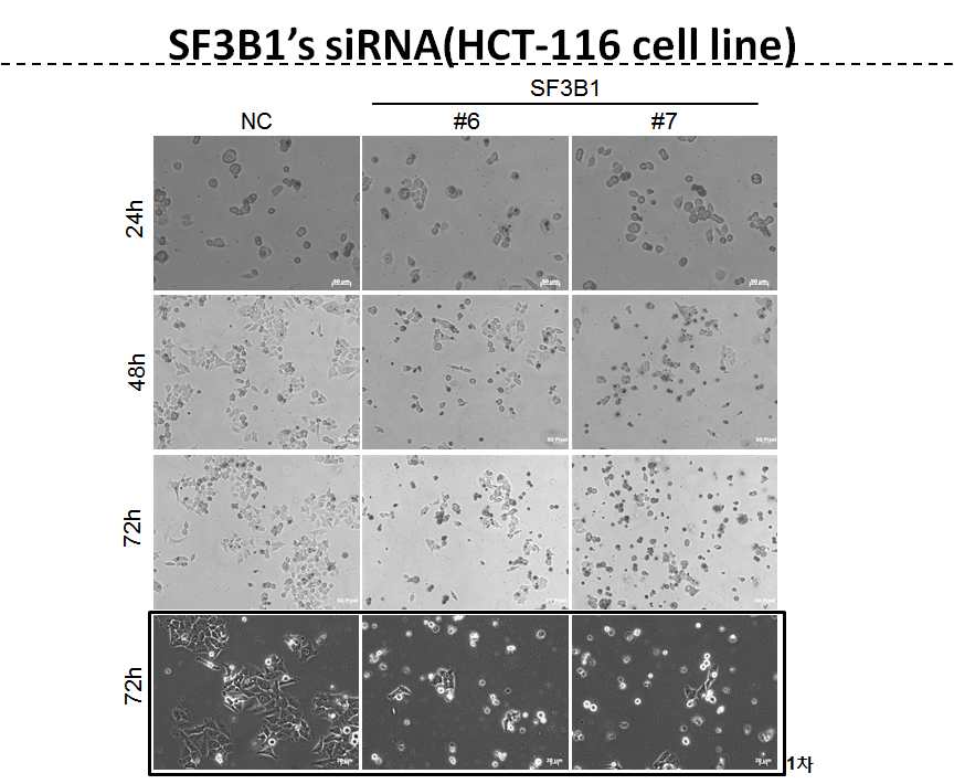 그림 2-84. AGS 및 HCT-116 cell line에 대하여 SF3B1의 발현을 suppress 했을 때 나타나는 cell death현상