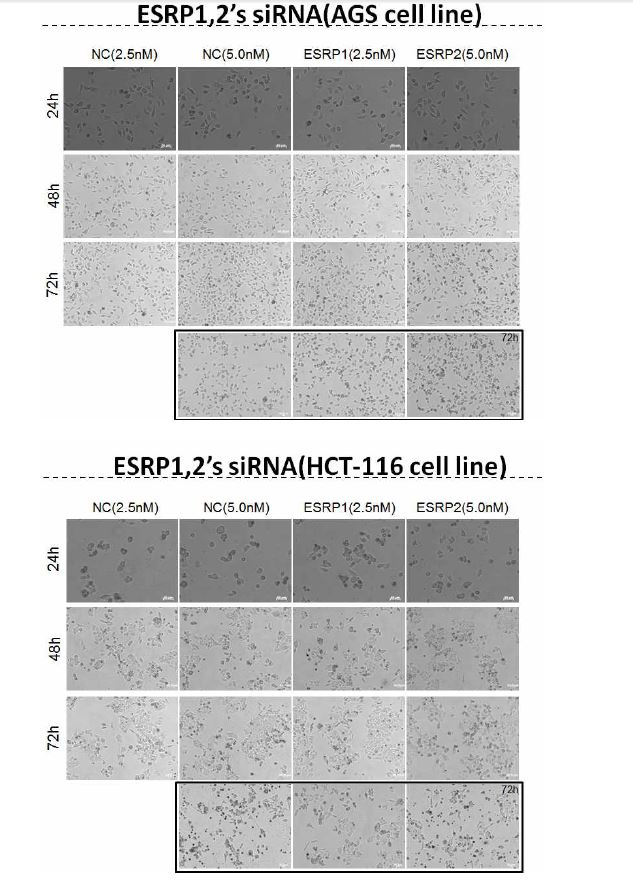 그림 2-85. AGS 및 HCT-116 cell line에 대하여 ESRP1/2의 발현을 suppress 했을 때 나타나는 cell의 변화