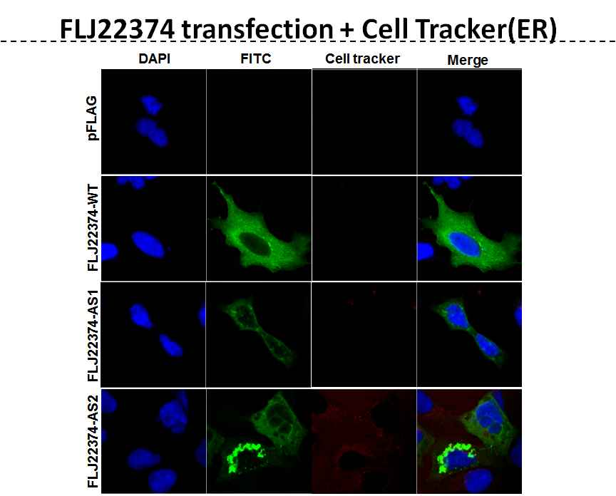 그림 2-91. HEK-293 cell에서 mitotracker, phalloidin, ER tracker를 이용하여 FLJ22374의 발현위치를 분석한 결과