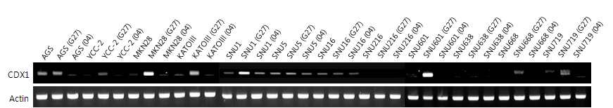 Figure7. CDX1발현을 RT-PCR로 확인