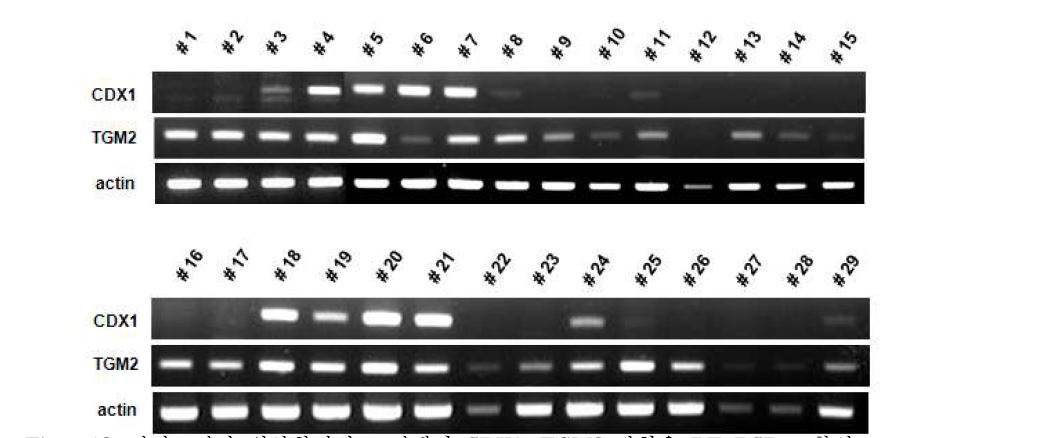 Figure13. 정상조직과 위암환자의 조직에서 CDX1, TGM2 발현을 RT-PCR로 확인