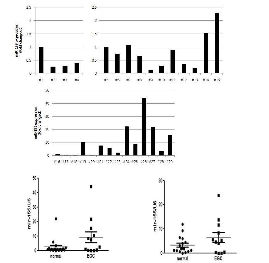 Figure14. 정상환자와 위암환자의 조직에서 miR-155 발현을 real-time PCR로 확인