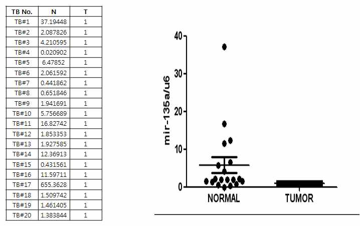 Figure18. 정상환자와 위암환자의 조직에서 miR-135 발현을 real-time PCR로 확인