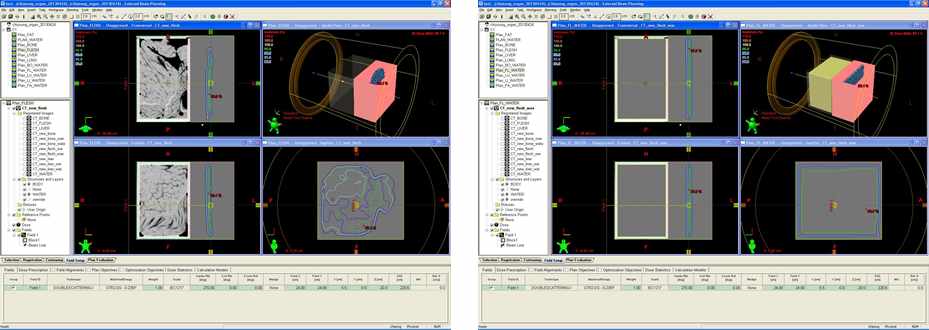 그림 24. 왼쪽의 그림은 Eclipse (v.8.1)에서 CT로 찍은 동물 장기를 넣은 용기를 이용하여 만든 치 료계획을 보여주고 있다. 오른쪽의 그림은 아크릴 용기 안을 HU값 0으로 전부 바꾼 후 만든 치료계 획을 보여주고 있다
