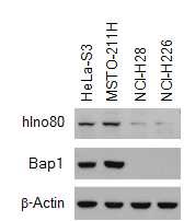 그림 11. MPM 암세포에서 Bap1 및 Ino80 발현 양