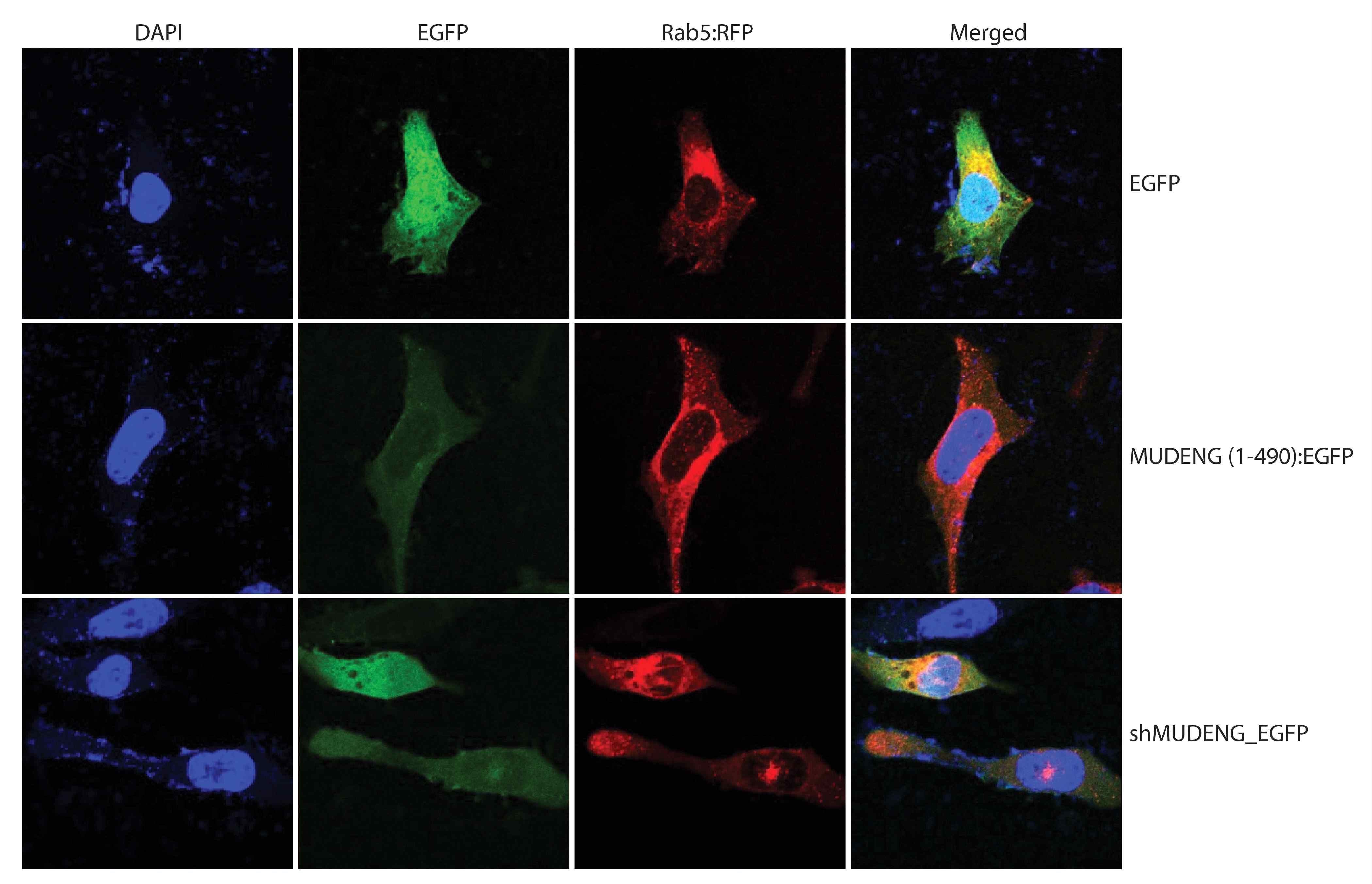 그림 19. HeLa 세포주에 Rab5:RFP, MUDENG (1-490):EGFP, shMUDENG_EGFP을 함께 도입 한 후 이들의 세포내 위치를 confocal microscope로 조사하였다
