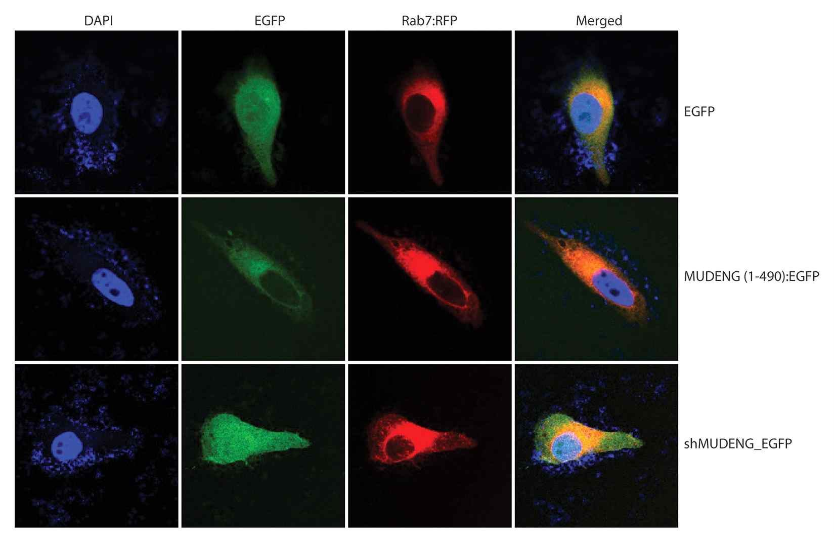 그림 20. HeLa 세포주에 Rab7:RFP, MUDENG (1-490):EGFP, shMUDENG_EGFP을 함께 도입 한 후 이들의 세포내 위치를 confocal microscope로 조사하였다.