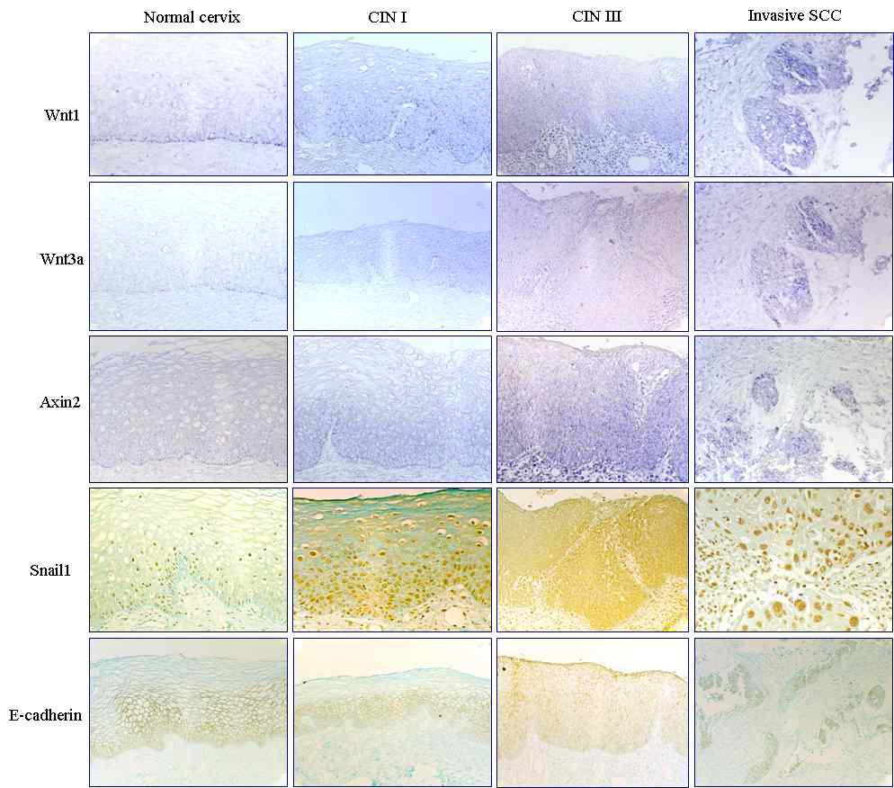 Wnt1, Wnt3a, Axin2의 mRNA levels은 in situ hybridization으로, Snail1과 E-cadherin protein 발현은 면역화학염색으로 조사하였을 때, 정상 자궁경부 점막에서는 Wnt1, Wnt3a, Axin2 mRNA는 기저층에 한정되어 발현되는데, Canonical Wnt 신호전달이 자궁 경부 상피세포의 self-renewal의 유지에 관여함을 암시함. 자궁경부의 정상점막, 전암병소(CIN I, CIN III), 침윤성 편평세포암종에 따른 암 진행 정도에 비례하여 Wnt/Axin2/Snail의 발현이 증가하고, E-cadherin의 발현은 줄어듬.