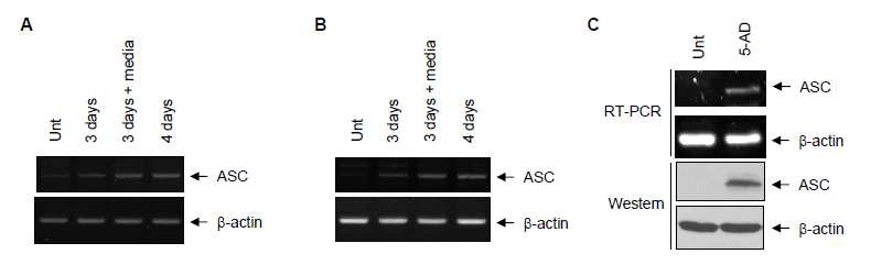 그림 3. Demethylating agent 처리를 통한 colorectal cancer cell (A,C: DLD-1, B: Colo320DM) 에서의 ASC 유전자의 발현