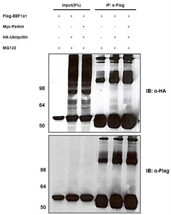 그림 8 Parkin induces eEF1A1 ubiquitination