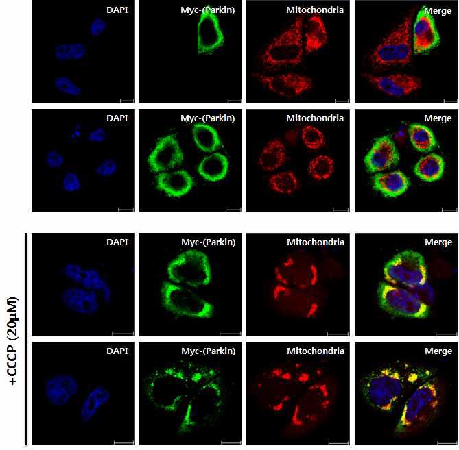 그림 15 mitophagy유도 시 parkin의 mitochondria로의 translocalization